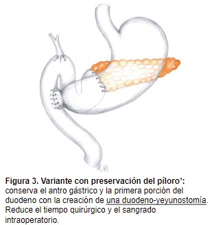 Preventiva