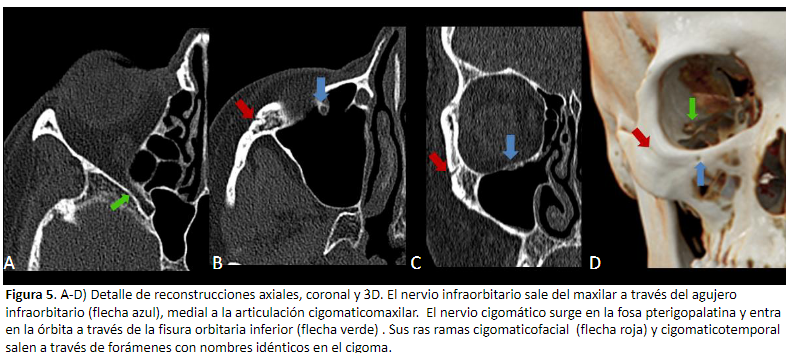 Preventiva