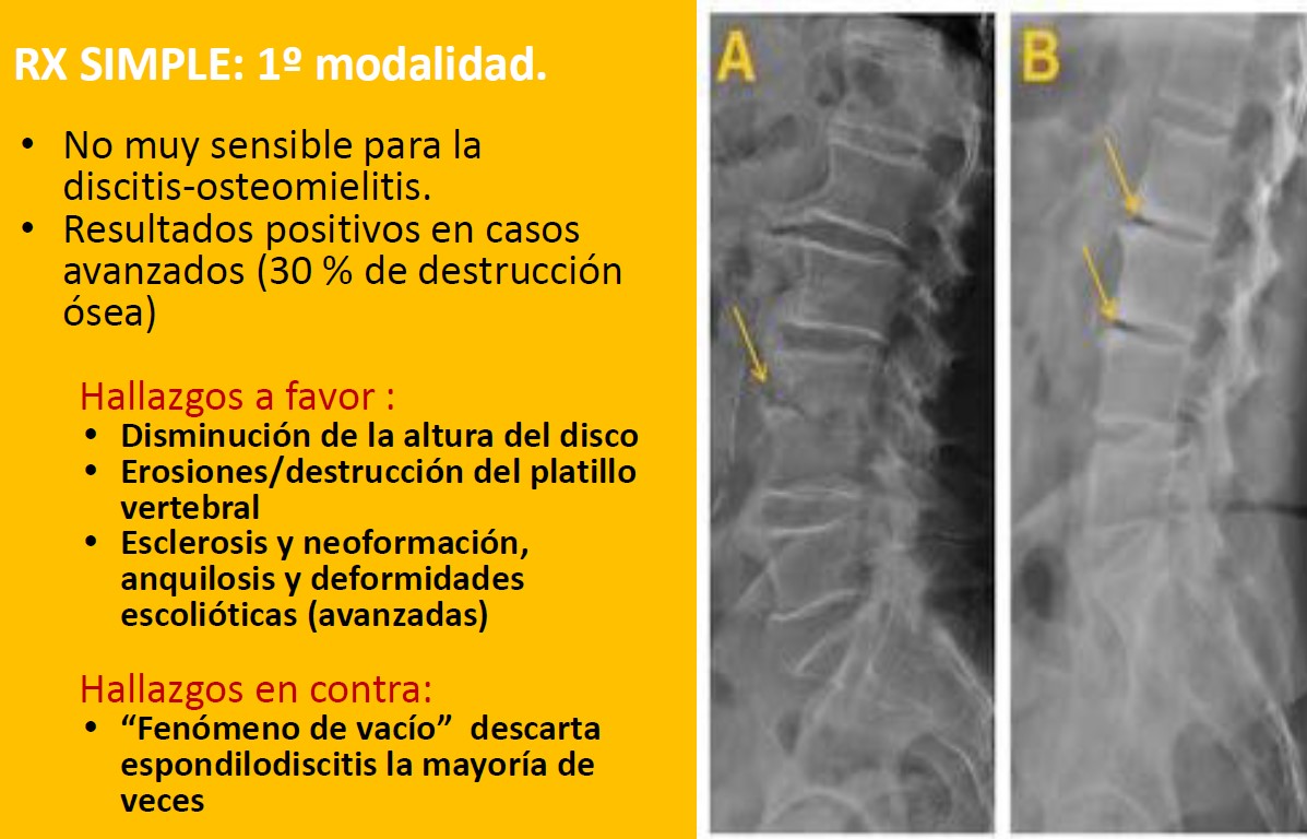 Preventiva